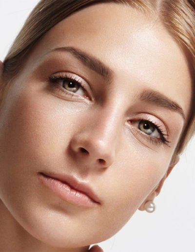Xanthelasma Removal Before & After Photos
